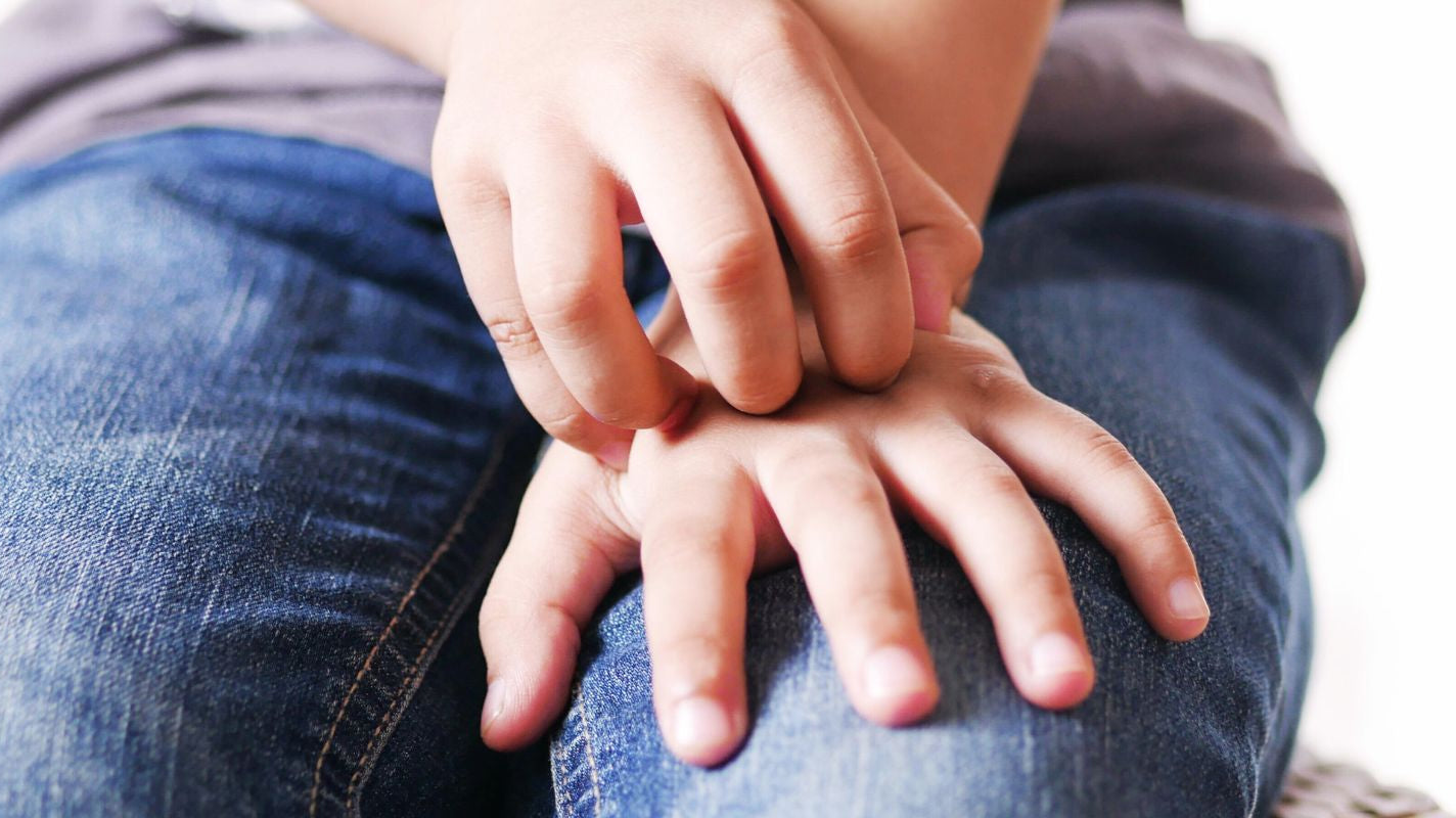 Soothe the Scratch: Tips to Tame Chronically Itchy Skin