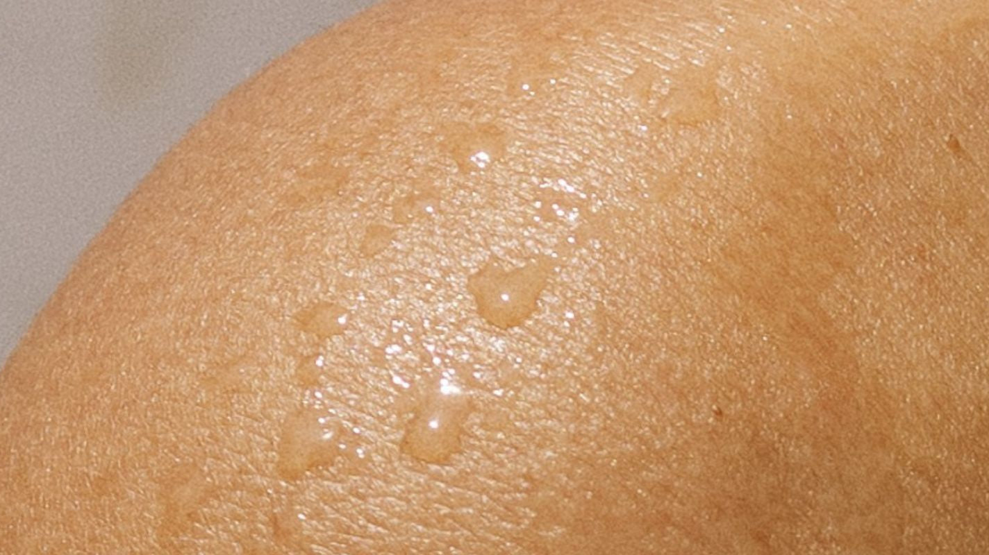 How to Winter-Proof Sensitive Skin