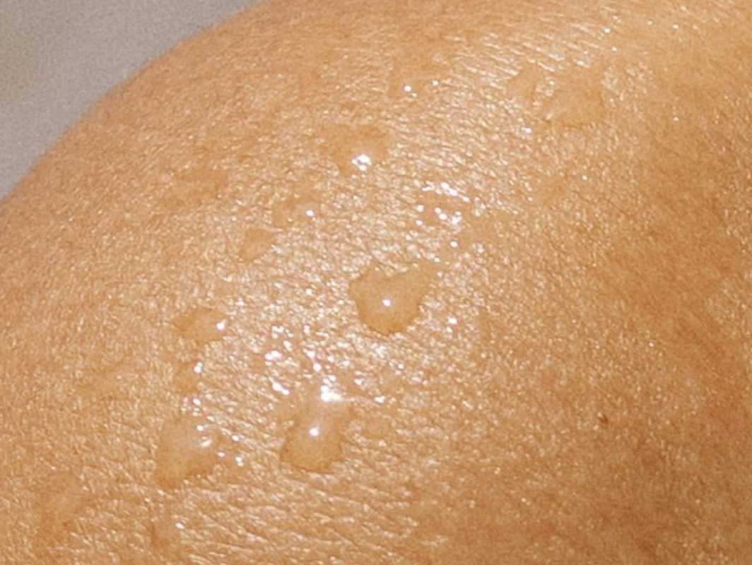 How to Winter-Proof Sensitive Skin