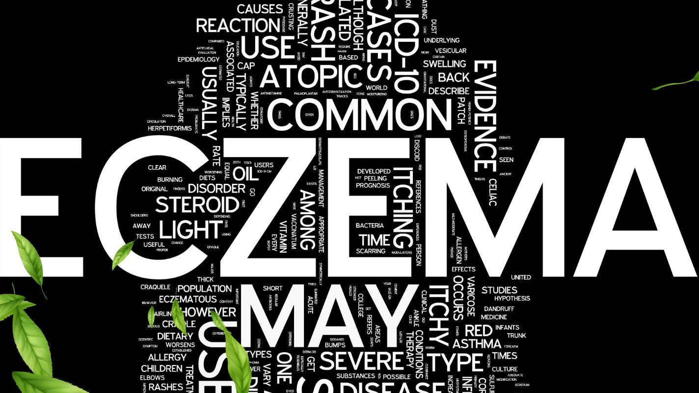 A Holistic Approach to Managing Eczema