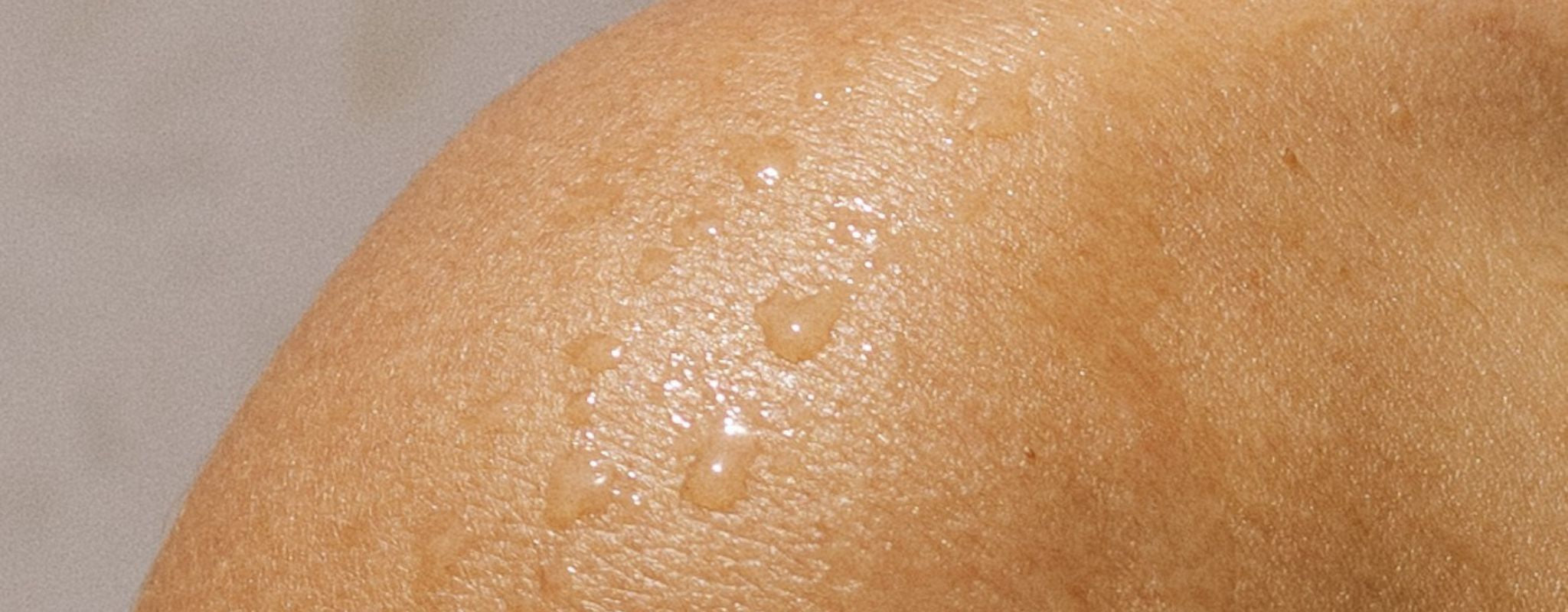 How to Winter-Proof Sensitive Skin