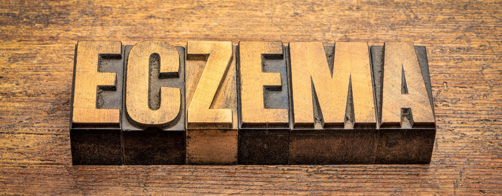 A Holistic Approach to Managing Eczema
